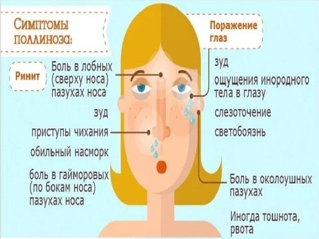 Сенная лихорадка поллиноз симптомы
